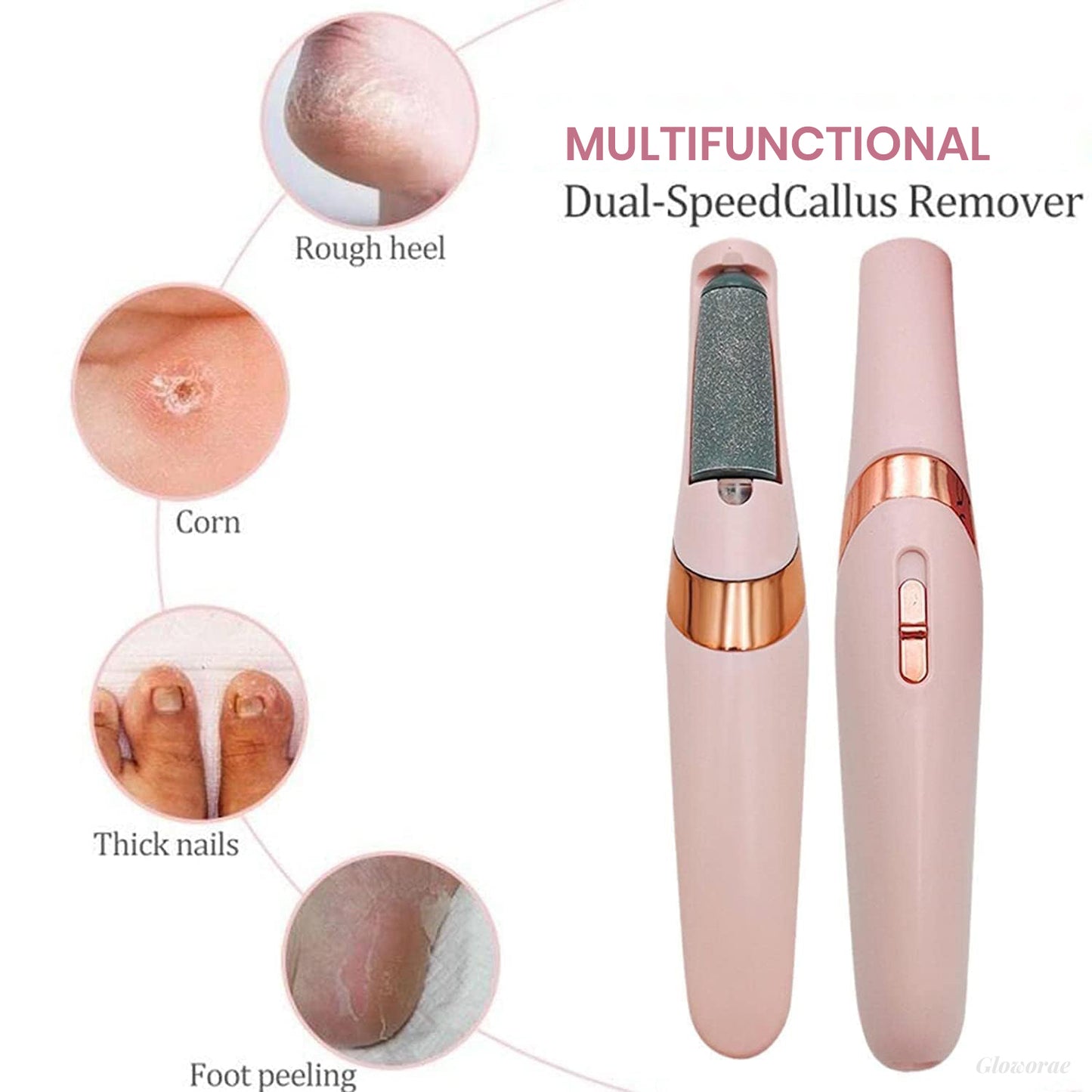 PediGlow™ Electric Callus Remover
