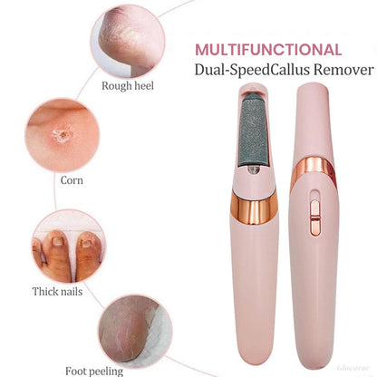 PediGlow™ Electric Callus Remover