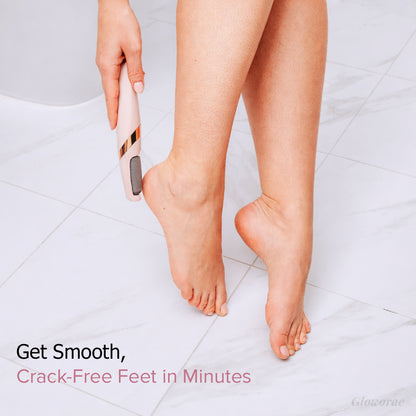 PediGlow™ Electric Callus Remover