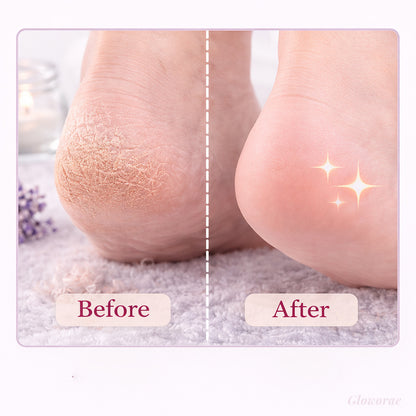 PediPeel™ Foot Renewal Mask