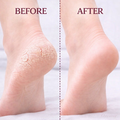 PediRelief™ Reflex Socks