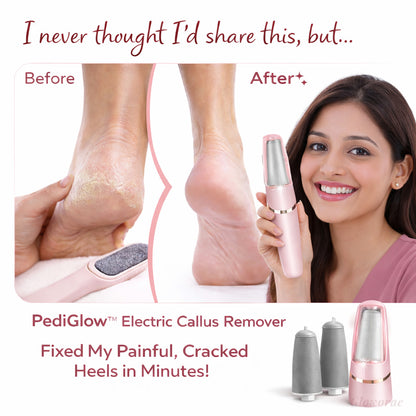 PediGlow™ Electric Callus Remover