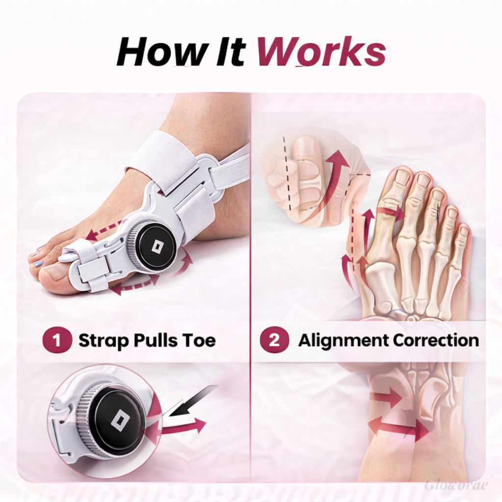 PediAlign™ Bunion Corrector